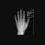 10 Ways AI Is Making Health Insurance Simpler to Understand